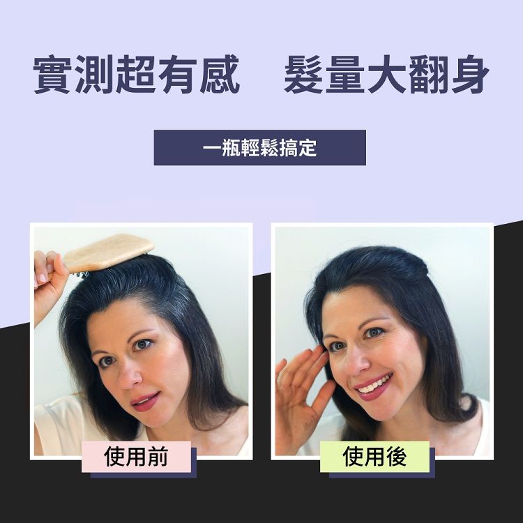 假髮 頂豐 假髮 噴霧式 噴霧式 頂豐