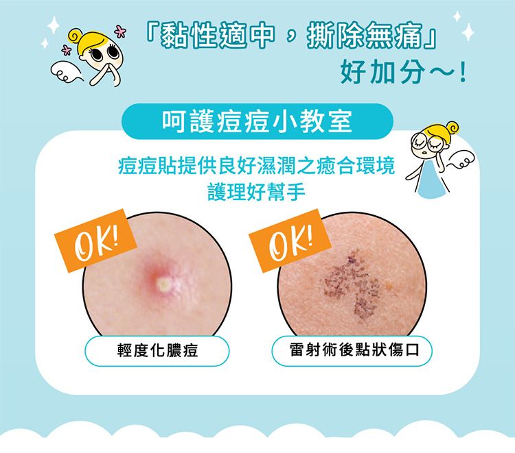 20260611160906268_750_0_80.jpg 防水 透氣 護妍天使 痘痘貼 隱形 痘痘貼