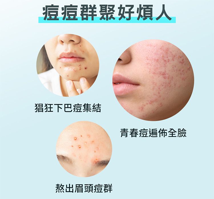 20260611163921257_750_0_80.jpg 防水 透氣 防水 護妍天使 護妍天使 水楊酸
