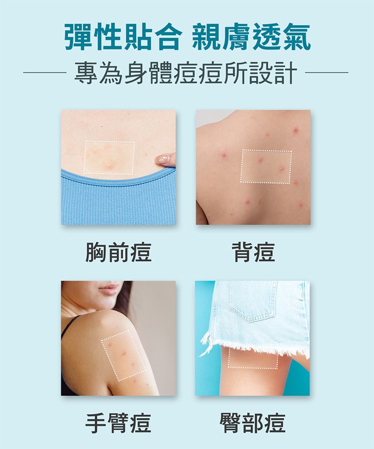 20260611162157466_750_0_80.jpg 防水 透氣 護妍天使 水楊酸 防水 護妍天使