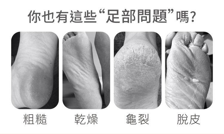 豐潤 保濕 護足霜 保濕 保濕 柔嫩