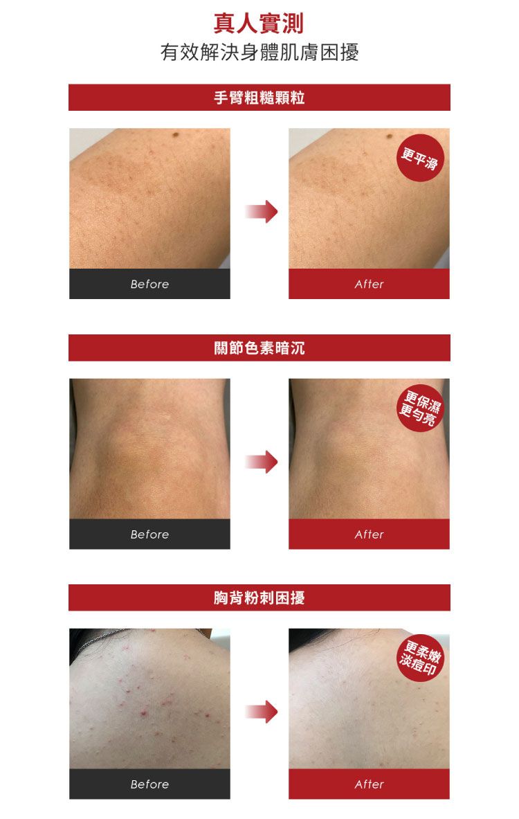 亮白 乳液 杏仁酸 煥膚 煥膚 身體乳