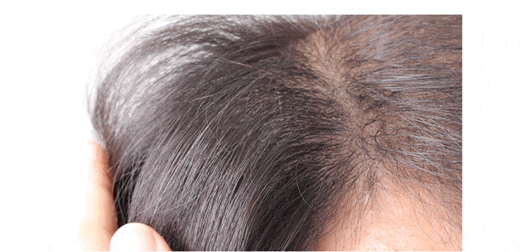 頭皮 洗髮精 豐盈 洗髮精 洗髮精 光澤