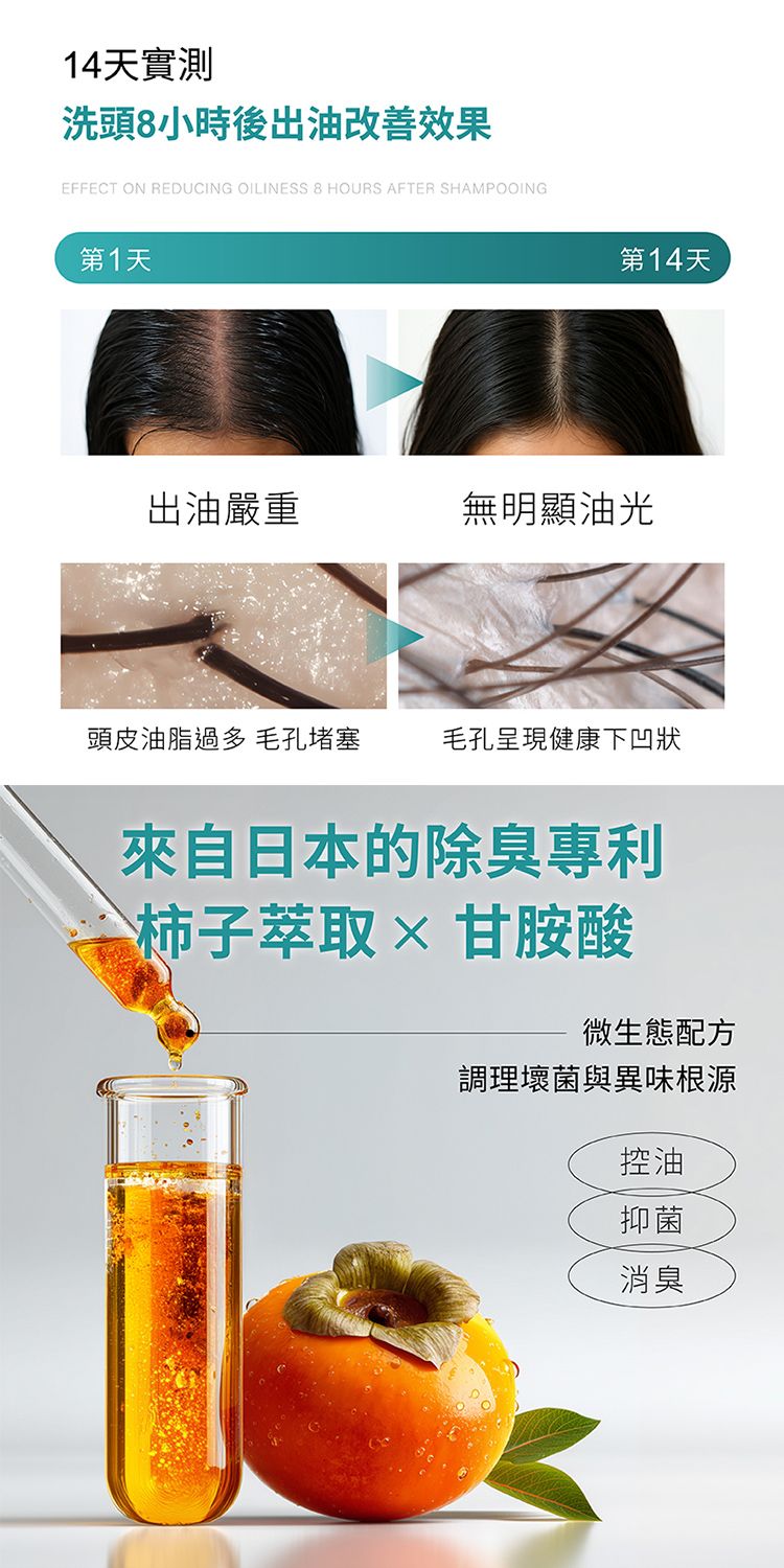 養髮液 頭皮護理 清爽 去油 頭皮 養髮液