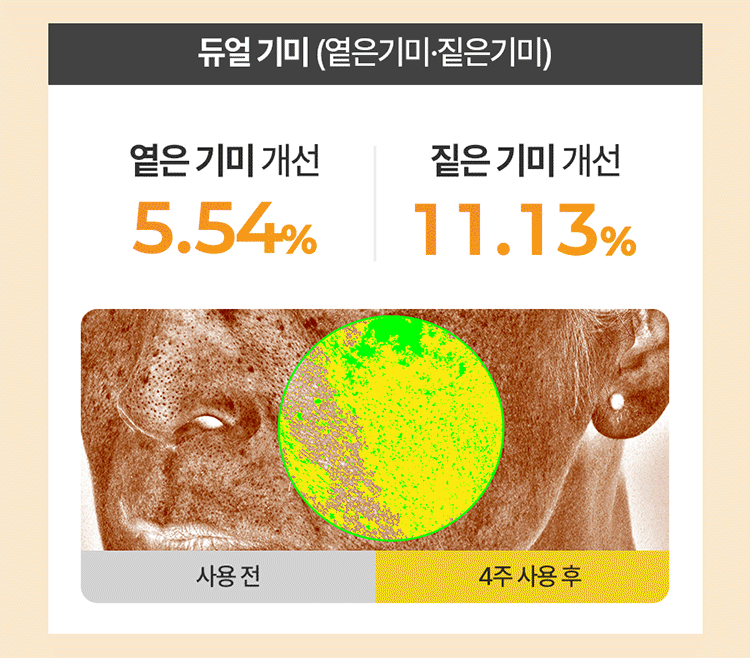 20260401090806073_700_0_80.gif 亮白 韓國 韓國 RiRe 亮白 RiRe