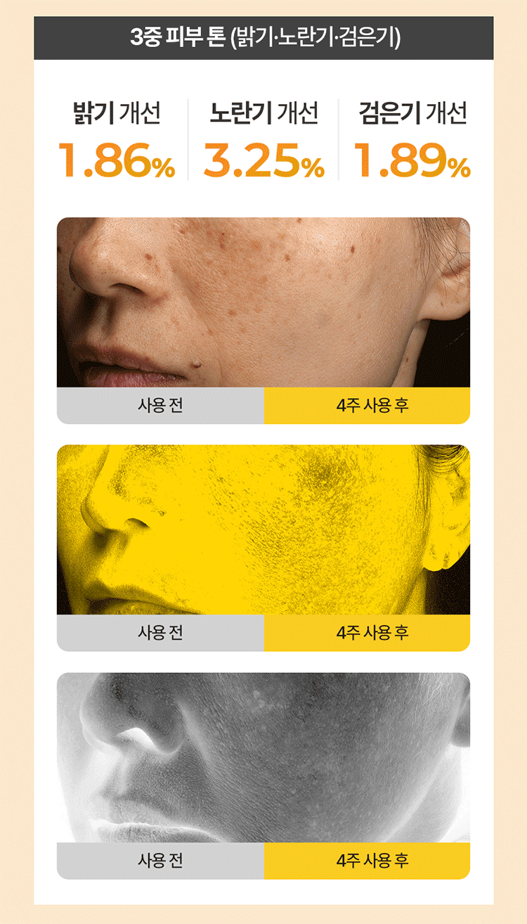 20260401090808308_700_0_80.gif 亮白 韓國 韓國 RiRe 亮白 RiRe