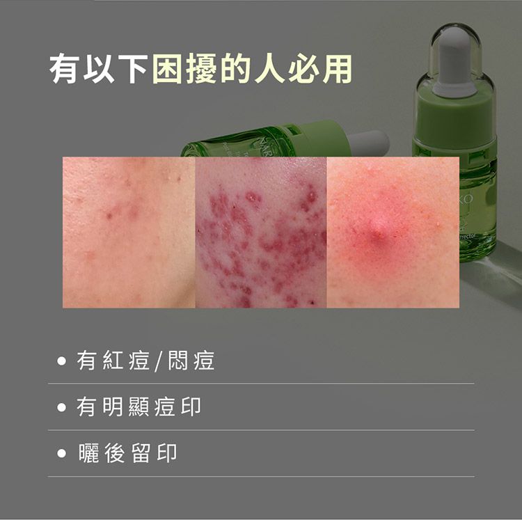 20260625173553375_750_0_80.jpg 修復 精華液 精華液 溫和 清爽 精華液