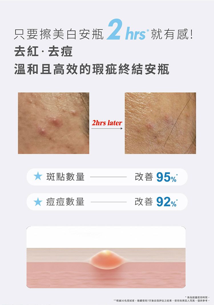 20260625173554093_750_0_80.jpg 修復 精華液 精華液 溫和 清爽 精華液